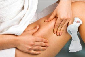 Cellulite Massage vákuummasszírozó, hogyan kell használni, hogyan működik , mellékhatások